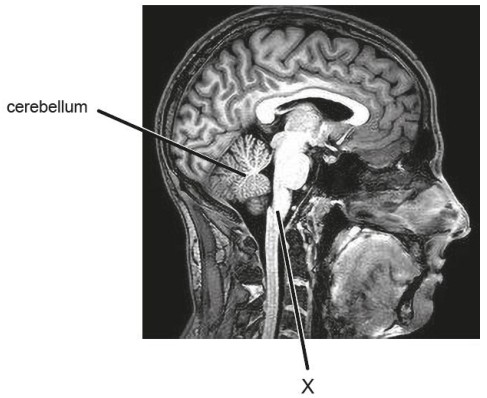 Figure for Answer to Question IB Biology SL C3.1.4 Brain As Information Integration Organ Questions question 1 — IB Biology SL