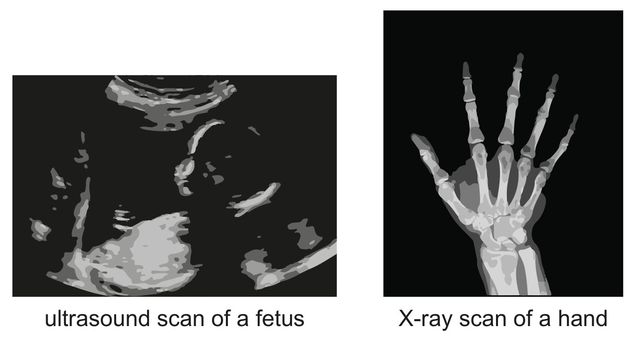 Fig. 8.1