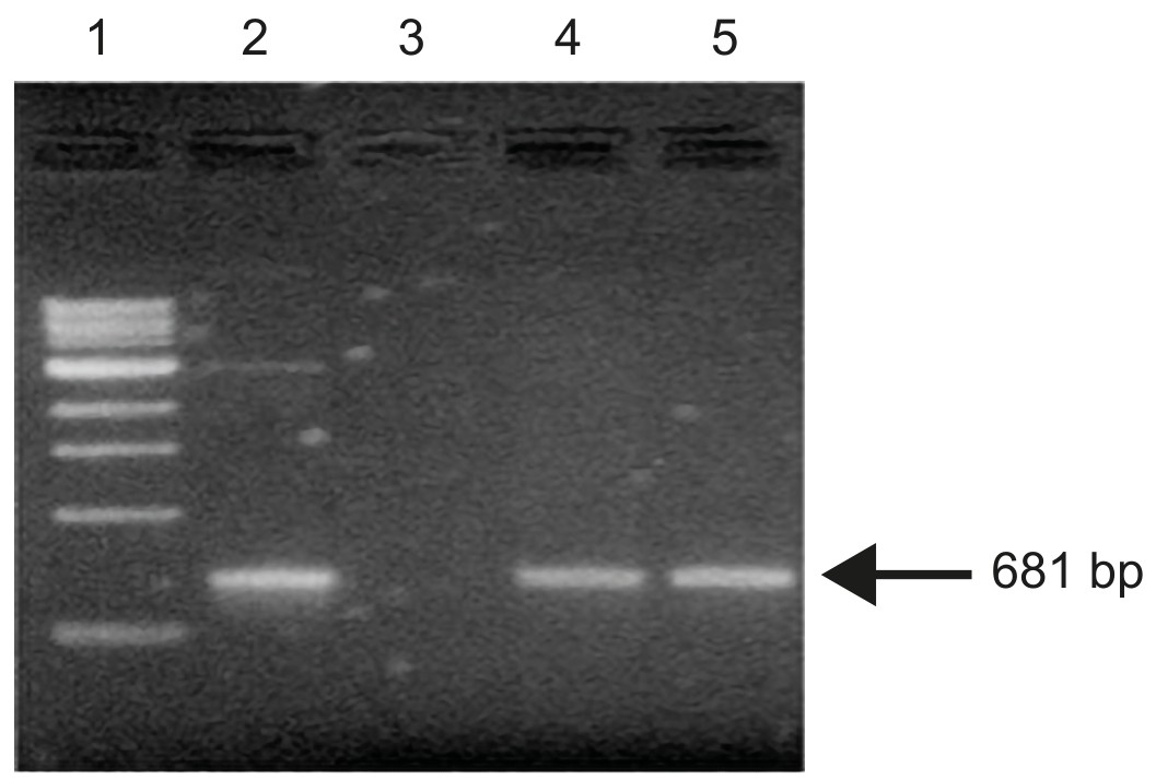 Figure for Question IB Biology HL D1.1.4 Pcr and Gel Electrophoresis Questions question 1 — IB Biology HL