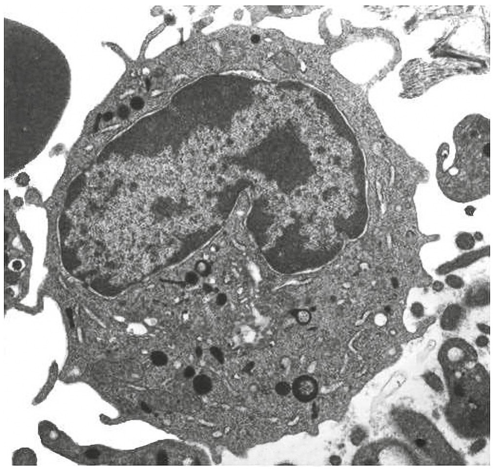 Figure for Question 1 — IB Biology HL