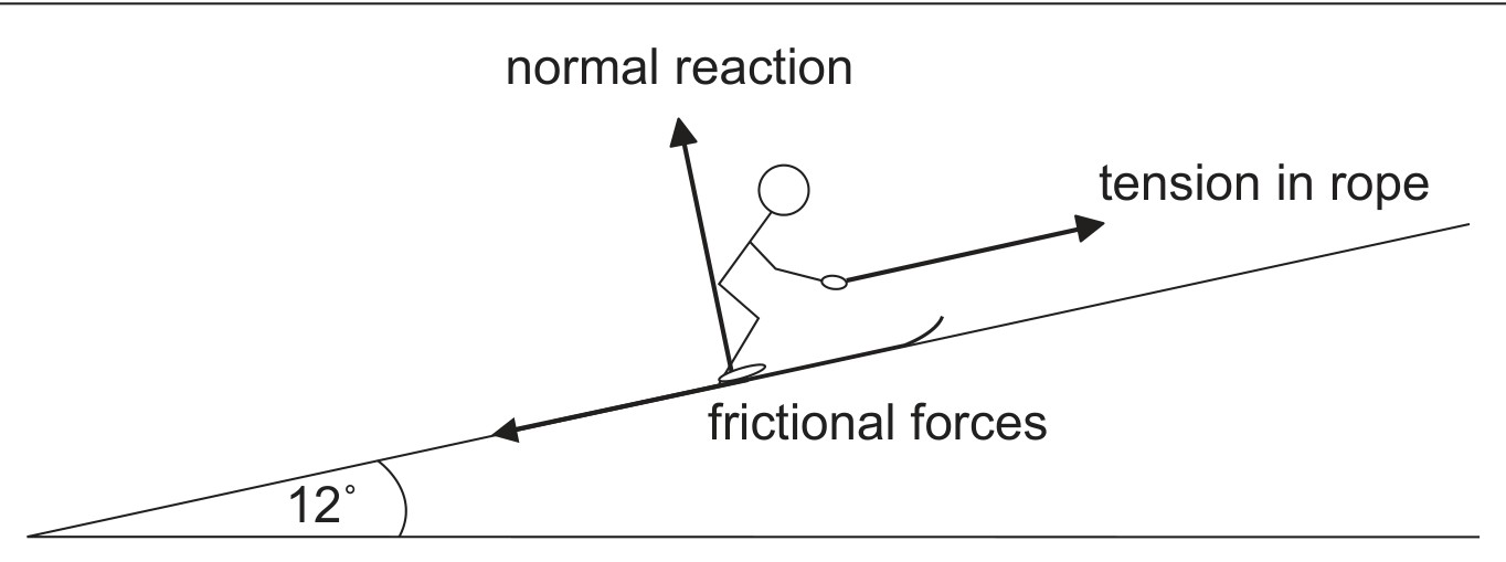 Figure for Question IB Physics HL A 2 8 Tension Questions question 1 — IB Physics HL