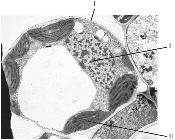 Figure for Question IB Biology SL A2.2.10 Cell Identification in Micrographs Questions question 1 — IB Biology SL