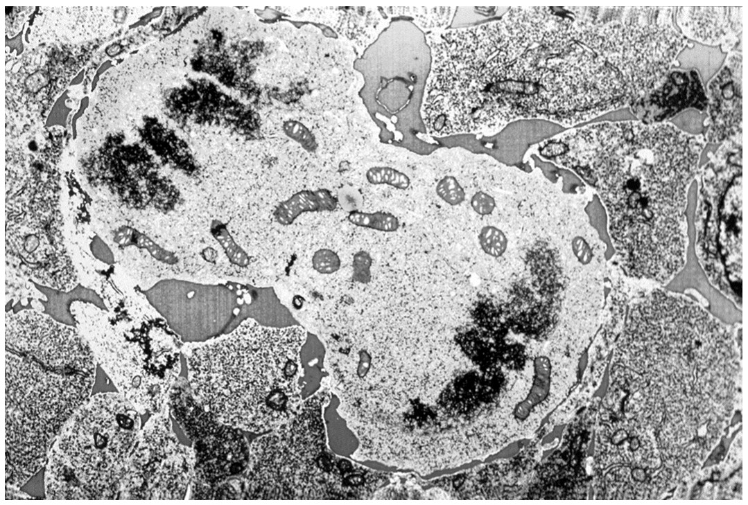 Figure for Question CAIE A-Level Biology AS 5.2.4 Mitosis Image Interpretation Questions question 1 — CAIE A-Level Biology AS