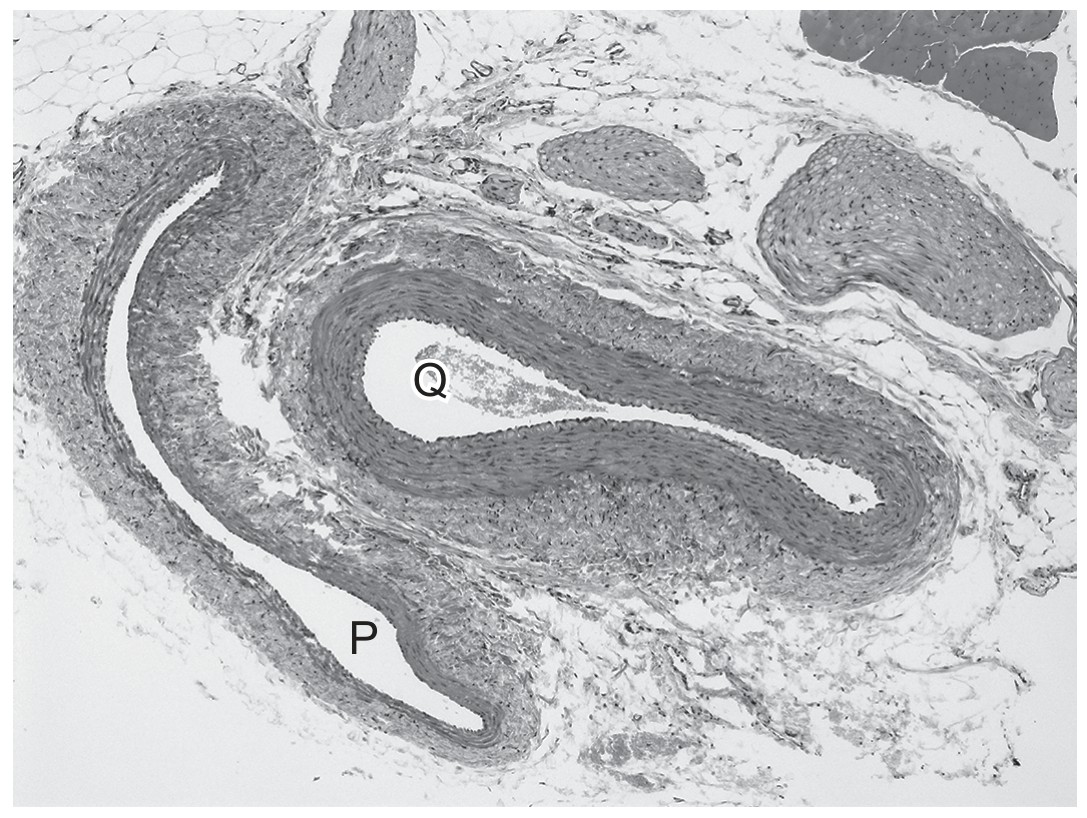 Figure for Question CAIE A-Level Biology AS 8.1.4 Blood Vessel Recognition Questions question 1 — CAIE A-Level Biology AS