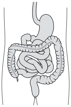 Figure for Question IB Biology SL C3.2.5 Phagocytes Questions question 1 — IB Biology SL